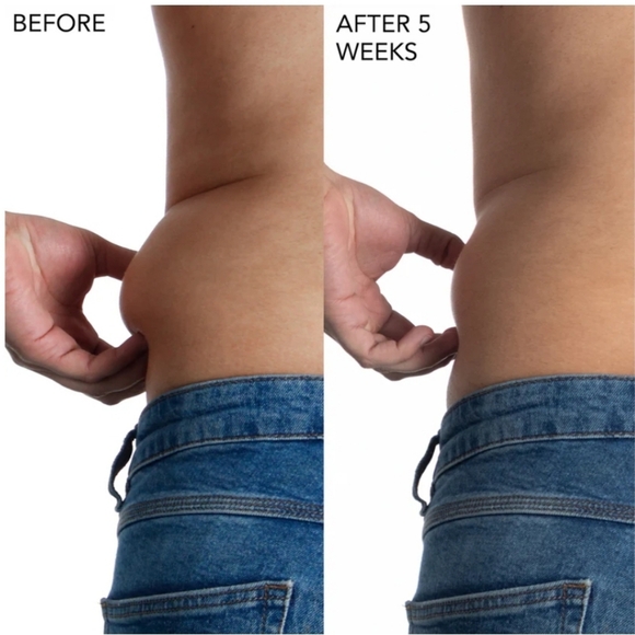 PRIMA Handheld Multipurpose Body Contouring & Cellulite Massager-NEW - Picture 7 of 9